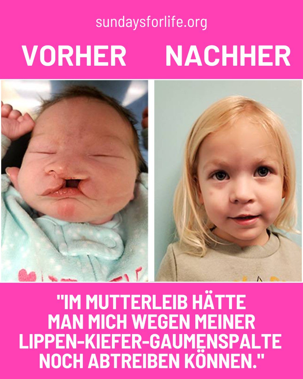 Der Leidensdruck, der durch angeborene Fehlbildungen entsteht, ist oft bei den Eltern größer als bei den Kindern selbst, was viele dazu veranlasst, sich für eine Abtreibung zu entscheiden. Viele dieser Entscheidungen werden jedoch aus Unkenntnis über Behandlungsmöglichkeiten und chirurgische Eingriffe getroffen. - Oberärztin Eva-Maria Baur  Es ist wichtig, die Menschen darauf aufmerksam zu machen, dass wir unsere Kinder nicht aufgrund von Perfektion selektieren und töten sollten. 