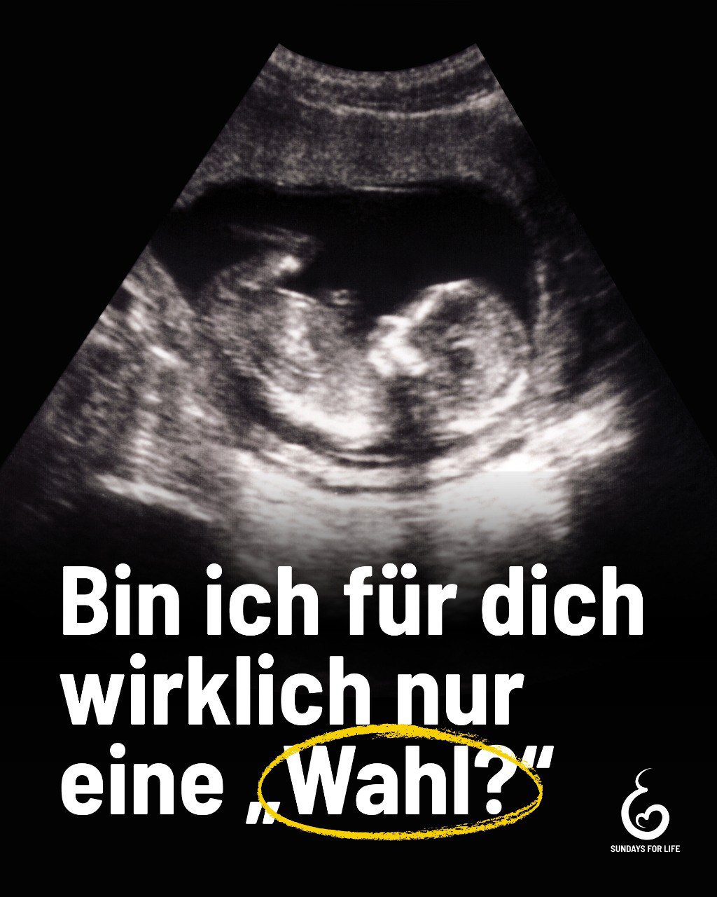 Es ist ein Kind – keine Wahl. Bei einer Abtreibung wird ein menschliches Leben beendet.