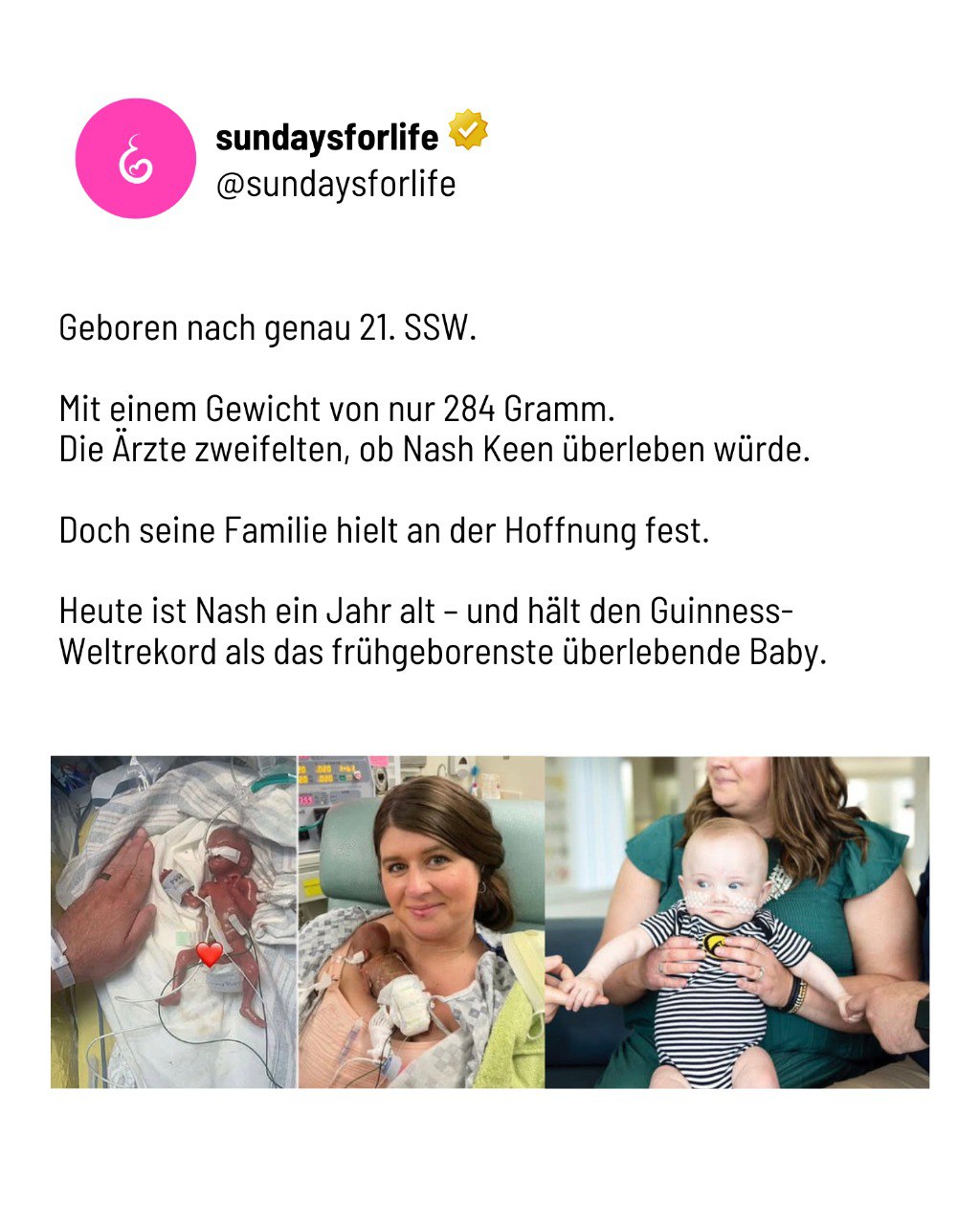 Ein Kind wie Nash hätte getötet werden dürfen – nur, weil es noch im Mutterleib war.