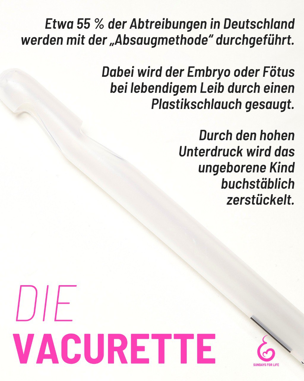 Unter sfl.onl/methoden findest du Informationen sowie unsere Abtreibungsprozedur-Videos zu den verschiedenen Methoden, mit denen ein sich entwickelnder Embryo oder Fötus abgetrieben wird.